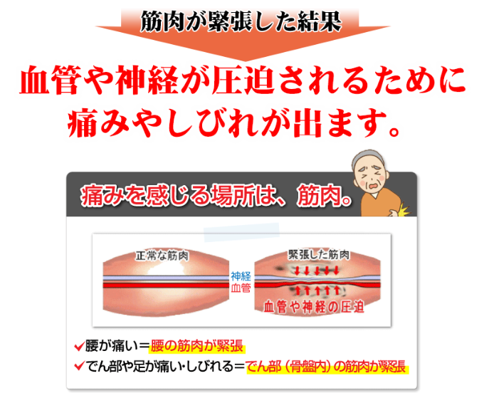 筋肉が緊張した結果、血管や神経が圧迫されるために痛みやしびれが出ます。